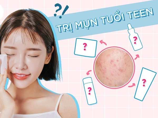 Cách hết mụn tuổi dậy thì hiệu quả tại nhà