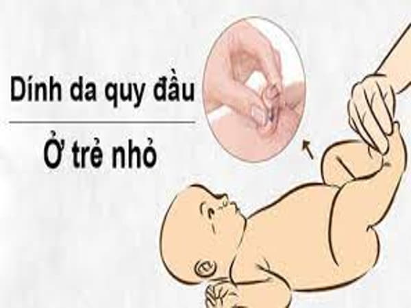 Hẹp bao quy đầu ở trẻ nhỏ có nguy hiểm không
