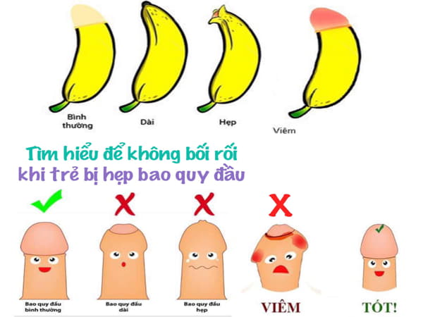 Hẹp bao quy đầu ở trẻ nhỏ là gì, hiểu để không bối rối