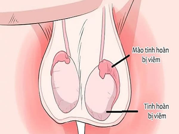 Tại sao nam giới nên kiểm tra tinh hoàn định kỳ