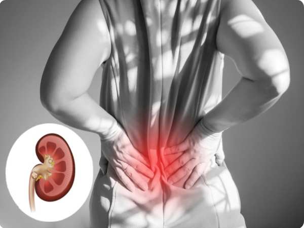 Triệu chứng nhận biết sỏi tiết niệu