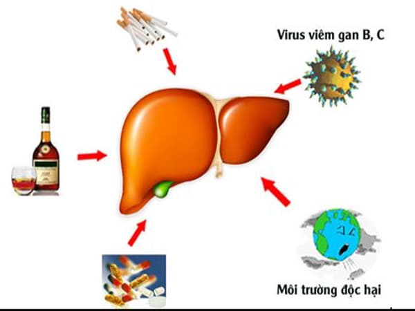 Vì sao cần giải độc gan thường xuyên