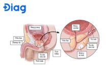 dấu hiệu ung thư tuyến tiền liệt